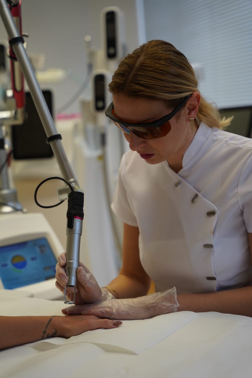 Détatouage laser - photo 4