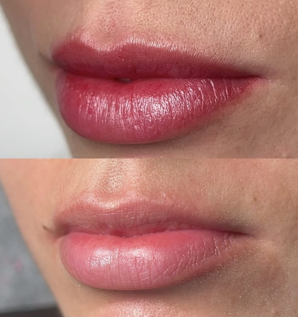 Maquillage permanent - photo 8