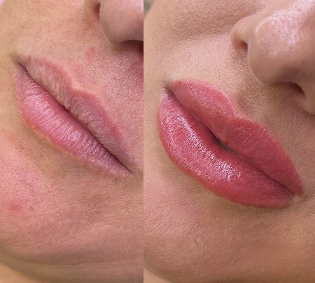 Maquillage permanent - photo 11